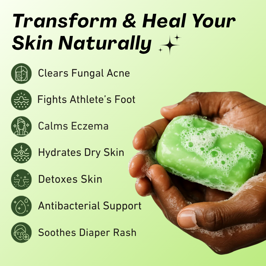 Luvira's Loravey® AntiFungal Relief Soap Bar
